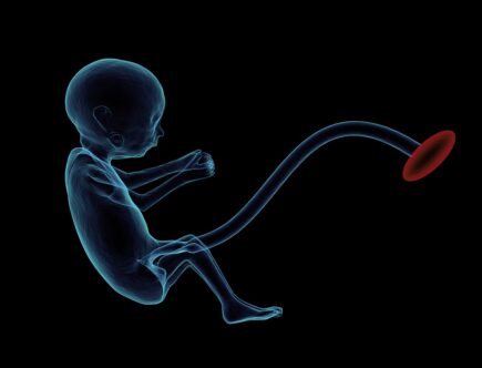 Zadbaj o bezpieczeństwo w ciąży! Zamów już dziś mobilne KTG Pregnabit